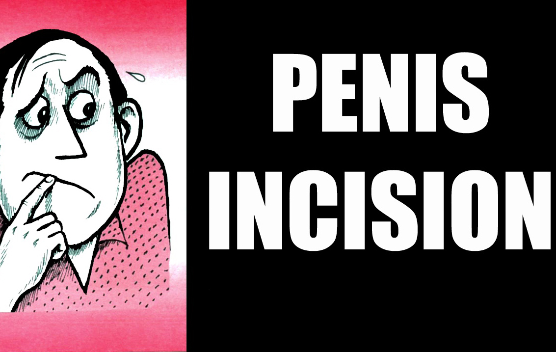 Penis Incision